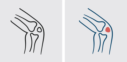 Orthopedic treatments may involve a range of approaches, including medication, physical therapy, exercise, bracing or splinting, minimally invasive procedures, and surgery