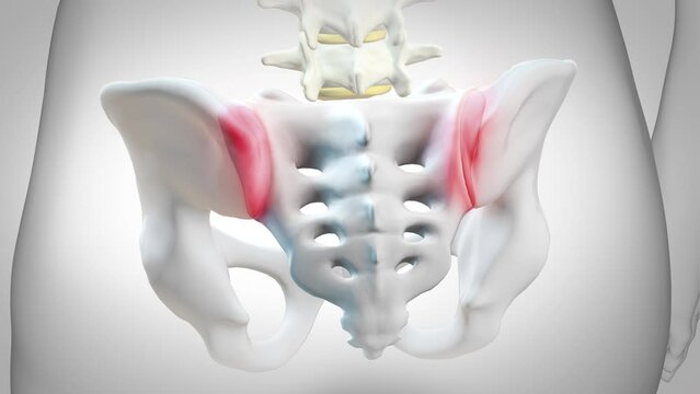 Inflammation of sacroiliac joints, called Sacroiliitis, causing pain in the lower back. 3d animation on white background
