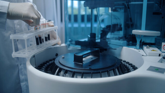 Male scientist puts blood samples from tube rack into modern automatic device for biochemical blood tests analyzing. Professional chemist works in biotechnology laboratory. Advanced research lab.