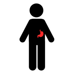 Vector illustrations of GERD stomach buoyancy for medical education.