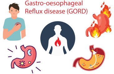 Gastro-oesophageal reflux disease (GORD),the stomach acid leak,heartburn,burning sensation in the chest,tomach acid comes back,bloating and belching,Gastroenteritis,Intestinal flu,stomach ache,five - obrazy, fototapety, plakaty