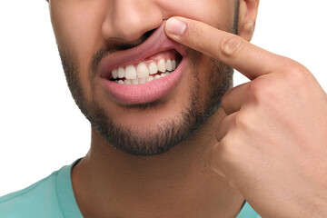 Man showing his healthy teeth and gums on white background, closeup
