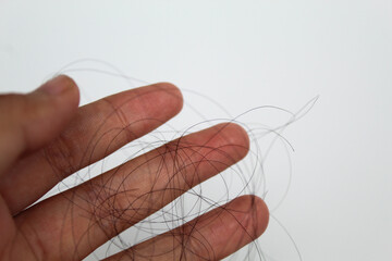 Strands of black hair on the palm of female hand. Hair loss or hair falling out or hair breakage