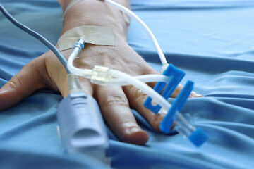 Woman patient in he bed with IV acess an pulse oximeter sensor in the hand. Close up of a...