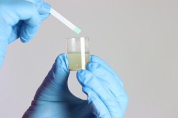Health care professional wearing gloves holding a cup with urine doing a glycemic test