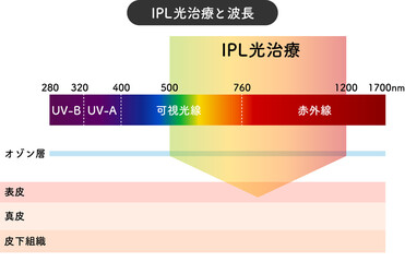 IPL光治療　アレキサンドライト　レーザー　波長　図　パルス幅 - obrazy, fototapety, plakaty