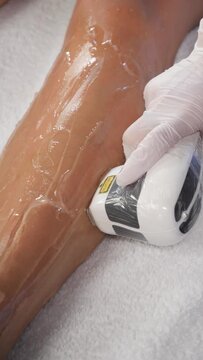 a beautician does laser hair removal on the leg