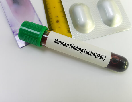 Blood sample for Mannose binding lectin or Mannan binding lectin test.