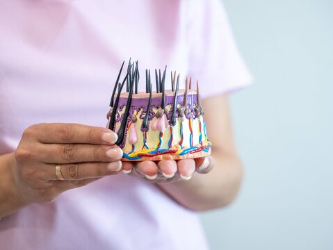 A female dermatologist or trichologist holds in her hands a model of the structure of human skin, a place for the test