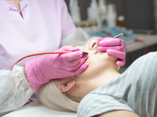 The process of epilation of unwanted facial hair of a woman is done by a master in pink gloves....