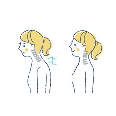 ストレートネックと正常な頚椎の比較　女性