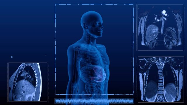 Magnetic resonance tomography  scan in different projections of the human digestive system. Anatomically accurate 3d render animation of the Stomach