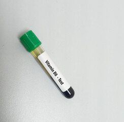Test tube with blood sample for vitamin B6(Pyridoxal 5-Phosphate) test, for vitamin B6 deficiency diagnosis. Pyridoxine.