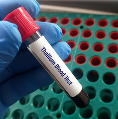 Hand holding blood sample for Thallium blood test, as a biomarker of acute thallium exposure.