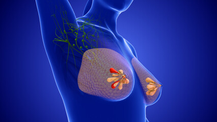 Medical animation for breast cancer