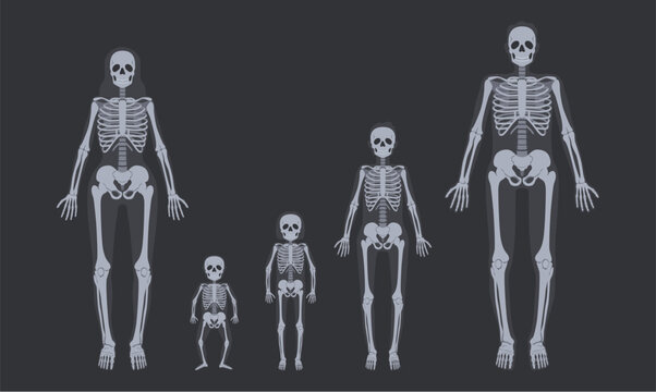 Family x-ray skeletons. Human skeletal systems from child to adult. Body anatomy vector illustration set