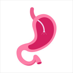 Obraz premium Gastroscopy procedure. Stomach polyps diagnostic. Human gastro. Vector illustration.