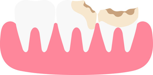 Dental Teeth Illustration