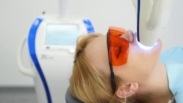 Close-up of female patient face at laser teeth whitening in the modern dental office. Blonde woman in protective red glasses bleaching teeth. Teeth whitening procedure with ultraviolet light UV lamp.
