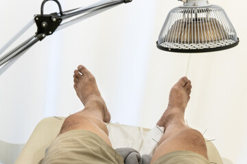 Patient receiving acupuncture treatment on legs and belly with infrared heater warming the treament area