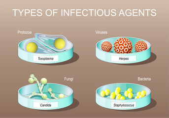 Petri dishes with Candida albicans, herpes viruses, staphylococcus, and toxoplasma