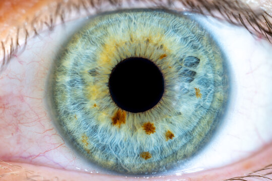 High Resolution Female Green-Blue Colored Eye with Brown Pigment Spots and Pupil Wide Open. Close Up. Structural Anatomy. Human Iris. Macro Detail. © Michael