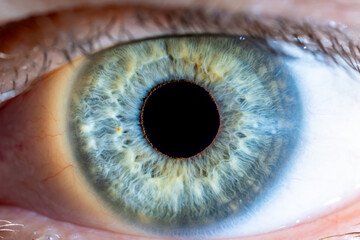 High Resolution male Green-Blue Colored Eye with Yellow Pigment Spots and Pupil Wide Open. Close...
