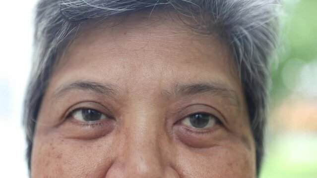 Close up elderly woman blinks her eyes at the camera : Elderly asians who do not wear eyeglasses have problems seeing astigmatism farsightedness and nearsightedness waiting for treatment.