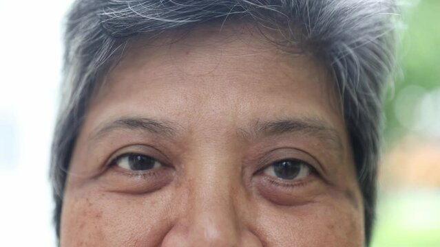 Close up elderly woman blinks her eyes at the camera : Elderly asians who do not wear eyeglasses have problems seeing astigmatism farsightedness and nearsightedness waiting for treatment.