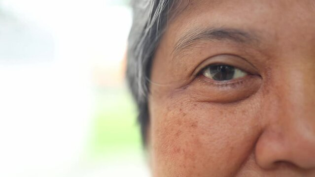 Close up elderly woman blinks her eyes at the camera : Elderly asians who do not wear eyeglasses have problems seeing astigmatism farsightedness and nearsightedness waiting for treatment.