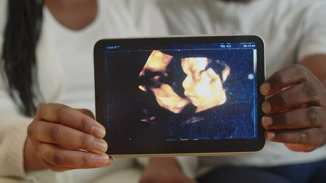 Close up of hands of unrecognizable black couple showing ultrasound picture of their baby on digital tablet