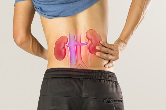 Kidney Failure Images – Browse 16,394 Stock Photos, Vectors, and Video |  Adobe Stock