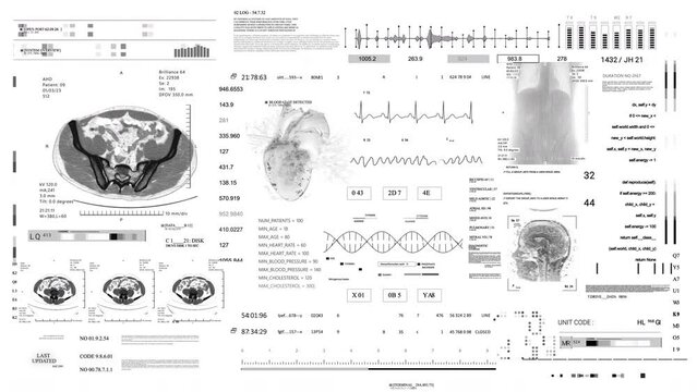 Medical UI.White background.Sceleton MRI x ray Scan, 3D Model Animation. Analyzing cardiac diagnosis.DNA. Heard rate monitor.HUD. Futuristic Technological Interface. Healthcare