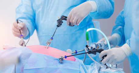 Doctor surgery working with modern laparoscopic equipment. Operation process on abdominal, blue...