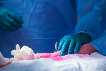 Surgery to restore patient arm in clinic. Surgeon installs metal screw pin to fuse radius bones.