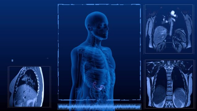 Magnetic resonance tomography  scan in different projections of the human digestive system. Anatomically accurate 3d render animation of the Duodenum