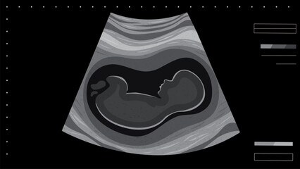 Ultrasound scan of baby vector illustration. Cartoon pregnancy screening. Ultrasound picture of fetus