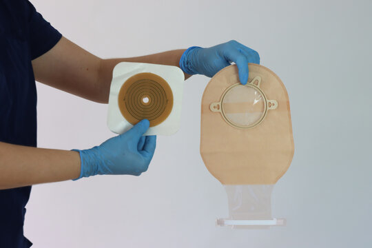 Health care professional holding the colostomy bag system with the hands wearing gloves 