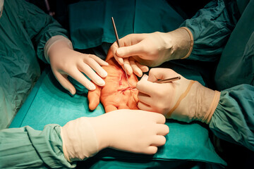 Hand surgery,  expert healthcare and specialized treatment for hand trauma and injuries.