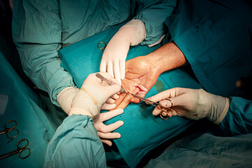 Skilled surgeon hands, in sterile gloves, performs precise suturing on a patient's hand , showcasing the professionalism and precision of healthcare in the medical industry.	
