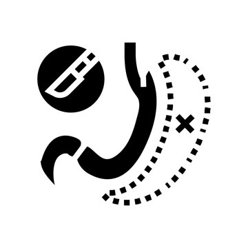 gastrectomy surgery doctor glyph icon vector. gastrectomy surgery doctor sign. isolated symbol illustration