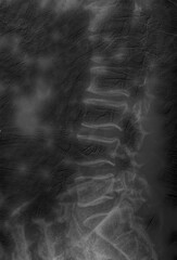 X-Ray image of human pelvis and spinal column in black and white