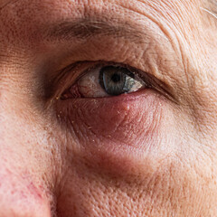 Macro shot of an elderly person's eye with visible wrinkles and details