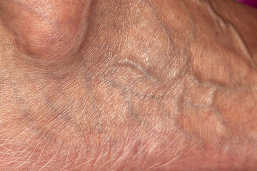 Macro shot of elderly skin showing intricate network of veins and wrinkles