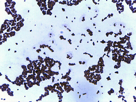 photo of bacteria microorganisms under the microscope
