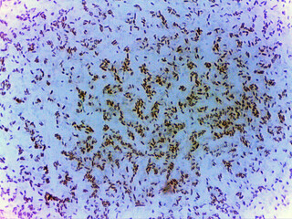 photo of bacteria microorganisms under the microscope
