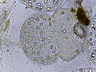 photo of tiny microorganisms under the microscope
