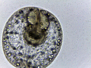 photo of tiny microorganisms under the microscope
