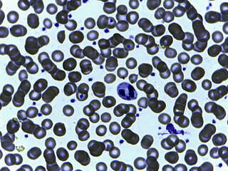 photo of bacteria microorganisms under the microscope
