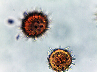 photo of tiny microorganisms under the microscope
